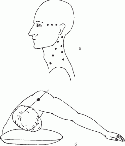 Точка 26. Массаж головы шиацу точки. Точечный массаж шиацу для головы. Массаж головы по точкам. Точки на голове для массажа.