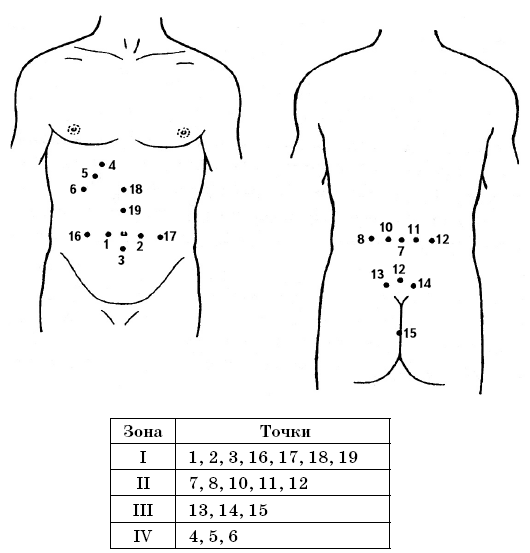 Куда ставить пиявки. Точки постановки пиявок при различных заболеваниях. Пиявки на почки схема постановки. Точки постановки пиявок на почки. Точки постановки пиявок при различных заболеваниях гирудотерапия.